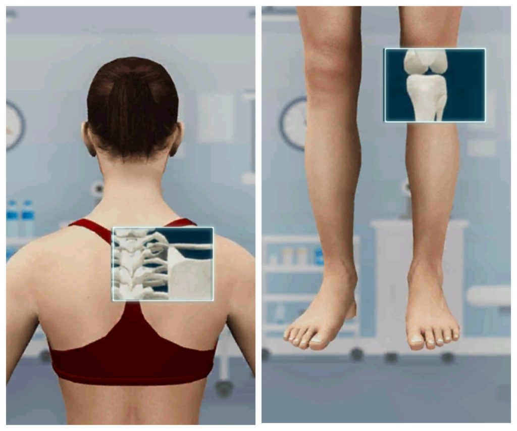 Xray Body Scanner - Simulation